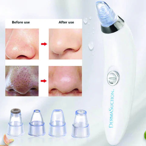 Blackhead Oil Remover Vacuum Suction Face Pore Cleaner Facial Beauty (cell Operated)